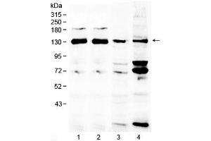 Western blot testing of 1) rat brain, 2) mouse brain, 3) human MCF7 and 4) human 293T lysate with NCKAP1 antibody at 0. (NCKAP1 antibody)