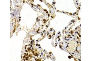 Immunohistochemistry of paraffin-embedded Human lung using TFDP1 Polyclonal Antibody at dilution of 1:200 (40x lens). (DP1 antibody)