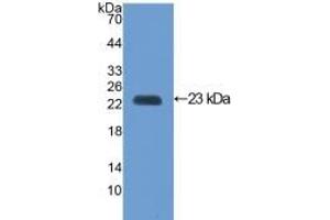 Detection of Recombinant VCAM1, Mouse using Polyclonal Antibody to Vascular Cell Adhesion Molecule 1 (VCAM1) (VCAM1 antibody  (AA 116-309))