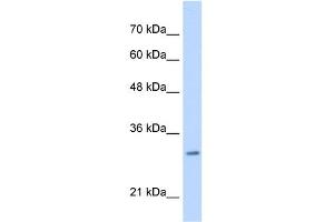 WB Suggested Anti-MLF2 Antibody Titration:  0. (MLF2 antibody  (C-Term))