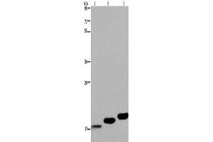 Gel: 8 % SDS-PAGE, Lysate: 40 μg, Lane 1-3: Mouse skeletal muscle, Mouse heart tissue, Mouse bladder tissue, Primary antibody: ABIN7130317(MYL12B Antibody) at dilution 1/450, Secondary antibody: Goat anti rabbit IgG at 1/8000 dilution, Exposure time: 20 seconds (MYL12B antibody)