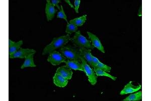 Immunofluorescent analysis of Hela cells using ABIN7157579 at dilution of 1:100 and Alexa Fluor 488-congugated AffiniPure Goat Anti-Rabbit IgG(H+L) (KIF11 antibody  (AA 920-1038))