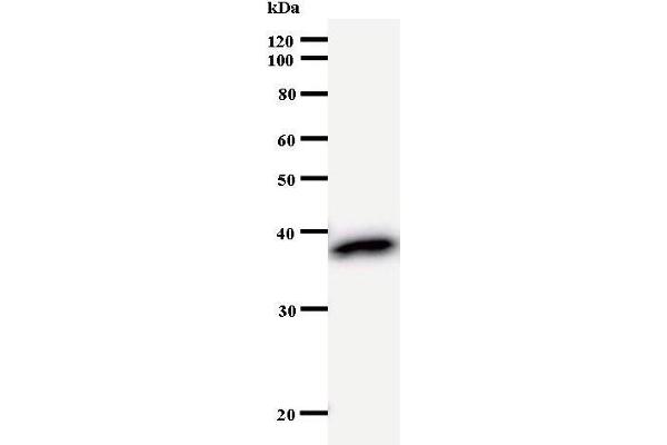 ZBTB49 antibody