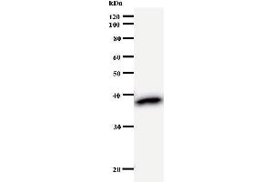 Western Blotting (WB) image for anti-Zinc Finger Protein 509 (ZBTB49) antibody (ABIN931073)