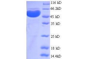 SDS-PAGE (SDS) image for Protein Arginine Methyltransferase 1 (PRMT1) (AA 1-248), (partial) protein (GST tag) (ABIN1047575) (PRMT1 Protein (AA 1-248, partial) (GST tag))