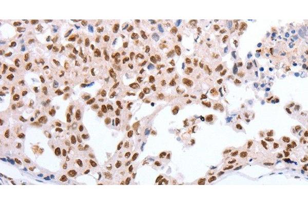 POU3F1 antibody