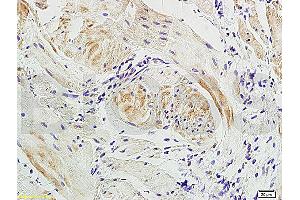 Formalin-fixed and paraffin embedded: dog bladder tissue labeled with Anti-Actin A/Alpha SMA Polyclonal Antibody, Unconjugated (ABIN726050) at 1:300, followed by conjugation to the secondary antibody. (Actin antibody)