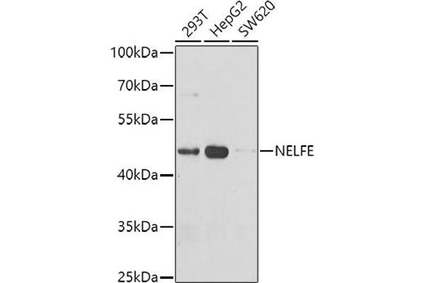 RDBP 抗体  (AA 1-280)