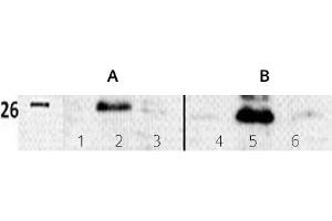 Image no. 3 for anti-Twist Homolog 1 (Drosophila) (TWIST1) (N-Term) antibody (ABIN347415) (TWIST1 antibody  (N-Term))