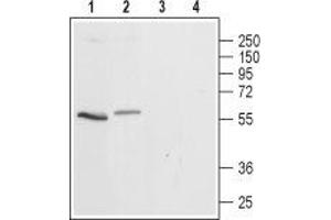 Western blot analysis of rat (lanes 1 and 3) and mouse (lanes 2 and 4) brain lysates: - 1,2. (Serotonin Receptor 3A antibody  (2nd Cytoplasmic Loop))