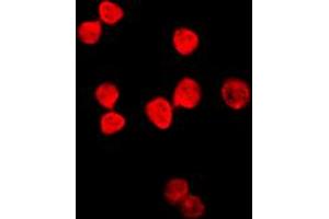 Immunofluorescent analysis of Thymine DNA Glycosylase staining in HeLa cells. (TDG antibody  (Center))