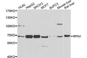 Western blot analysis of extracts of various cell lines, using RPN1 antibody. (RPN1 antibody)