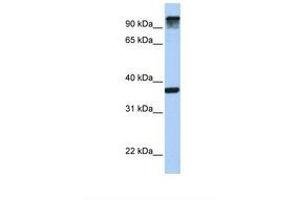 Image no. 1 for anti-Epidermal Growth Factor Receptor Pathway Substrate 15 (EPS15) (AA 794-843) antibody (ABIN6738963) (EPS15 antibody  (AA 794-843))