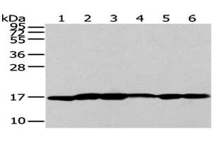 Western Blot analysis of A431 cells and Human liver cancer tissue, Lovo and PC3 cells, Human placenta tissue and 293T cells using UTS2B Polyclonal Antibody at dilution of 1/200 (Urotensin 2B antibody)