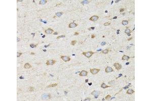 Immunohistochemistry of paraffin-embedded Rat brain using CLIC4 Polyclonal Antibody at dilution of 1:100 (40x lens).