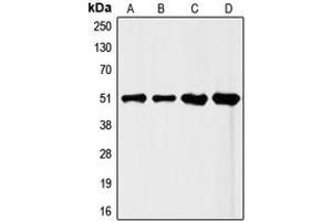 Western blot analysis of FLI1 expression in HeLa (A), Jurkat (B), mouse liver (C), rat liver (D) whole cell lysates. (FLI1 antibody  (Center))