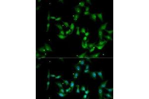 Immunofluorescence analysis of MCF7 cells using IL17F Polyclonal Antibody (IL17F antibody)