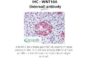 Image no. 1 for anti-Wingless-Type MMTV Integration Site Family, Member 10A (WNT10A) (Internal Region) antibody (ABIN1740816) (WNT10A antibody  (Internal Region))