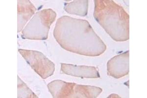 IHC-P analysis of Rat Tissue, with DAB staining. (Thrombospondin 1 antibody  (AA 957-1129))