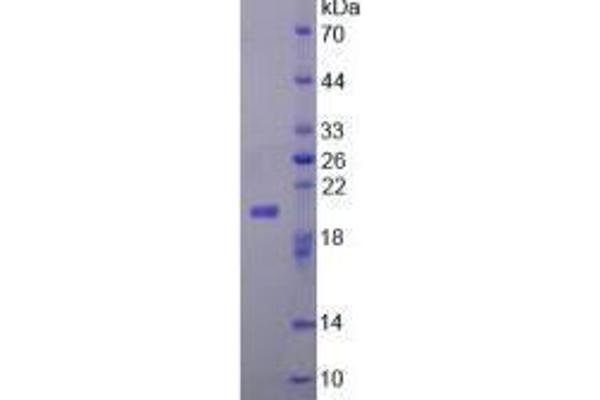 FGF22 Protein (AA 26-162) (His tag)