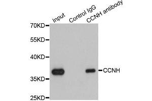 Immunoprecipitation analysis of 200 μg extracts of K562 cells using 1 μg CCNH antibody (ABIN5970383). (Cyclin H antibody)