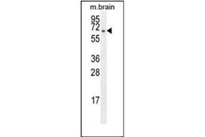 Western blot analysis of FBXO21 Antibody (C-term) Cat. (FBXO21 antibody  (C-Term))