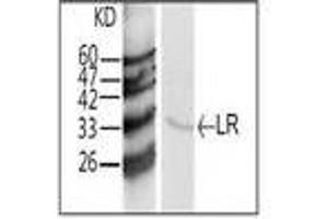 Image no. 1 for anti-Ribosomal Protein SA (RPSA) antibody (ABIN791538) (RPSA/Laminin Receptor antibody)