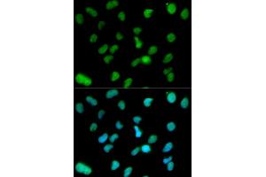 Immunofluorescence analysis of HeLa cell using KDM1A antibody. (LSD1 antibody  (AA 130-380))