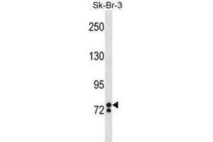 ZNF263 Antibody (Center) western blot analysis in SK-BR-3 cell line lysates (35 µg/lane). (ZNF263 antibody  (Middle Region))