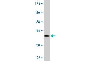 Western Blot detection against Immunogen (37. (PCDHGA2 antibody  (AA 223-331))