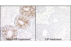 Immunohistochemistry (IHC) image for anti-Minichromosome Maintenance Complex Component 2 (MCM2) (pSer53) antibody (ABIN7449430)