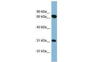 HIRIP3 antibody used at 1 ug/ml to detect target protein.