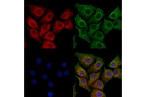 ABIN7094398 and ABIN7098445 staining HepG2 cells by IF/ICC. (NOMO2 antibody  (C-Term))