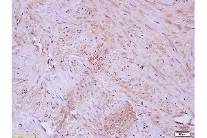 Immunohistochemistry (IHC) image for anti-Elastin (ELN) (AA 681-786) antibody (ABIN734003)