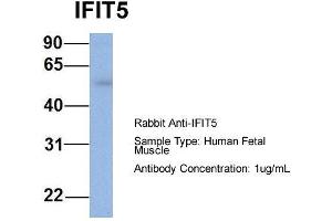 Host: Rabbit  Target Name: IFIT5  Sample Tissue: Human Fetal Muscle  Antibody Dilution: 1. (IFIT5 antibody  (Middle Region))