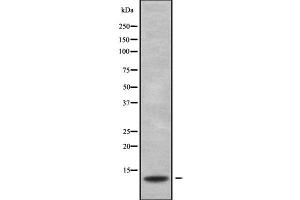 Western blot analysis S100G using HeLa whole cell lysates (S100G antibody  (Internal Region))