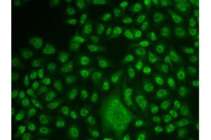 Immunofluorescence analysis of U2OS cells using TFPT antibody. (TFPT antibody)