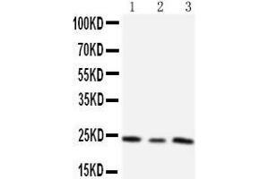 Anti-TIMP4 antibody,  Western blotting Lane 1:  Cell Lysate Lane 2: HELA Cell Lysate Lane 3: SMMC Cell Lysate (TIMP4 antibody  (C-Term))