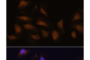 Immunofluorescence analysis of U-2 OS cells using P90RSK Polyclonal Antibody at dilution of 1:100. (RPS6KA3 antibody)