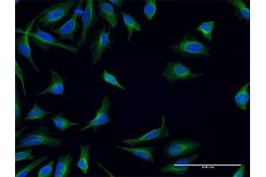 Immunofluorescence of monoclonal antibody to FPR2 on HeLa cell. (FPR2 antibody  (AA 163-205))