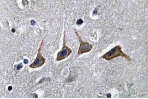 Immunohistochemistry analyzes of SLC22A6 / OAT1 Antibody in paraffin-embedded human brain tissue. (SLC22A6 antibody)