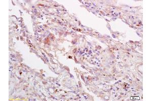 Immunohistochemistry (IHC) image for anti-Tumor Necrosis Factor (Ligand) Superfamily, Member 9 (TNFSF9) (AA 101-200) antibody (ABIN705056)