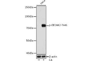 Western blot analysis of extracts of various cell lines, using Phospho-PKR/EIF2-T446 Rabbit mAb  at 1:1000 dilution. (EIF2AK2 antibody  (pThr446))
