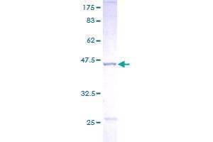 NME1 Protein (AA 1-152) (GST tag)