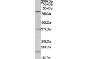 Western Blotting (WB) image for anti-Potassium Voltage-Gated Channel, Shaw-Related Subfamily, Member 3 (KCNC3) (Internal Region) antibody (ABIN2465018)