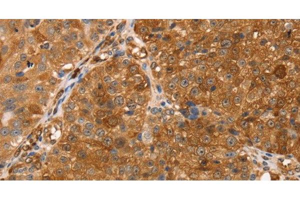 Thymosin beta 10 antibody