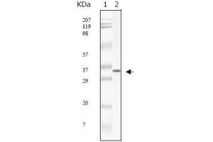 Western Blot showing SARS-mpm antibody used against SARS-mpm recombinant protein.