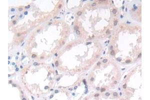 DAB staining on IHC-P; Samples: Human Kidney Tissue (APLP2 antibody  (AA 607-852))