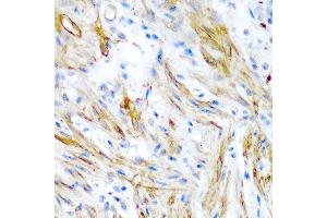 Immunohistochemistry of paraffin-embedded human colon using LMOD1 antibody at dilution of 1:200 (40x lens).