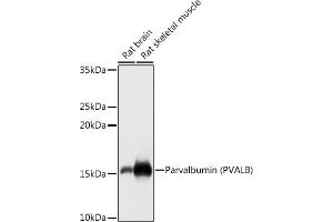 Western blot analysis of extracts of various cell lines, using Parvalbumin (PVALB) antibody (ABIN6128526, ABIN6146506, ABIN6146507 and ABIN6217573) at 1:1000 dilution.